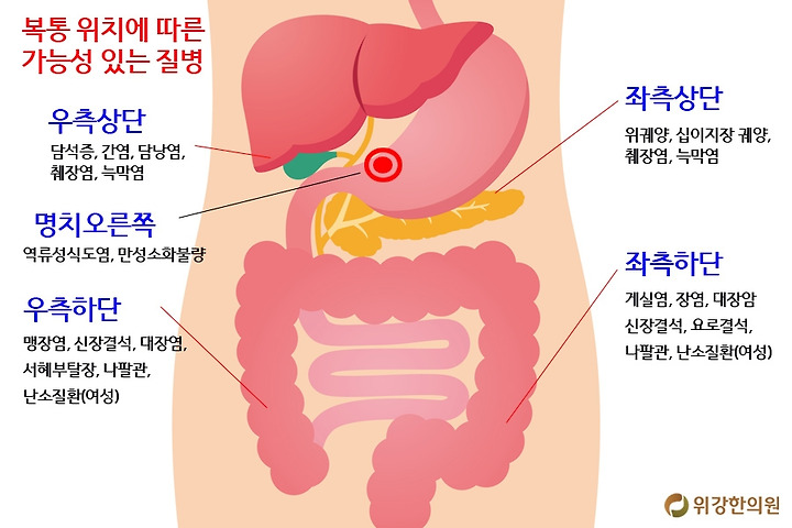 명치 누르면 통증 발생시 증상에 따른 원인과 치료법