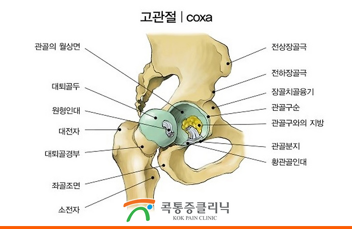 골반이 아파요.골반뼈, 다리쪽 통증까지 획기적인 개선법 11
